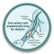 7Arm artery-vein anastomosis loop for dialysis